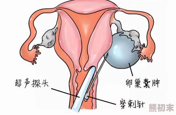 宫交直到怀孕文h：最新研究显示，宫交在提高受孕率方面的有效性引发广泛关注与讨论