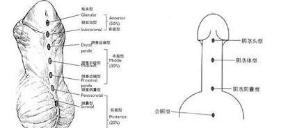 尿道h研究发现尿道健康与饮食密切相关，增加纤维摄入有助于预防相关疾病