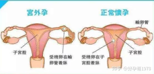 男生和女生怀孕的方法有哪些探索人类自然生育与辅助生殖技术及其伦理影响