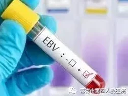 EB病毒怎么治疗目前尚无特效药，主要进行对症治疗和支持治疗，密切监测病情变化